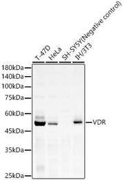 VDR Rabbit mAb