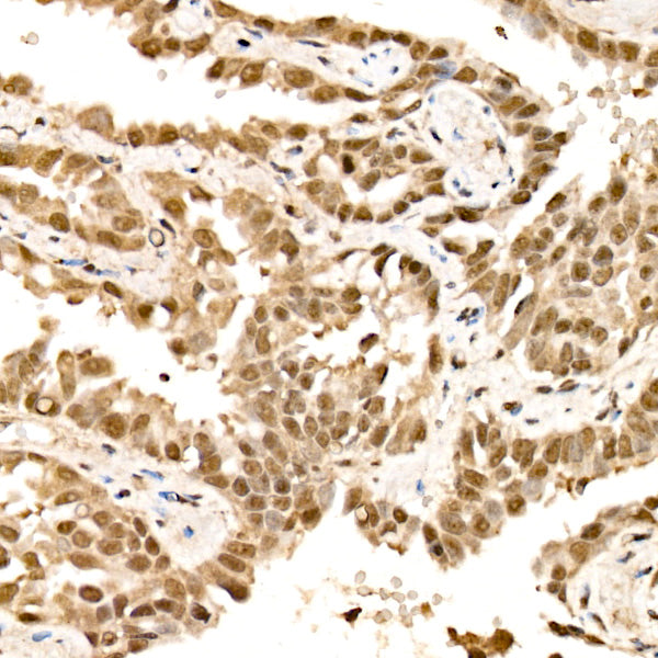 VDR Rabbit mAb