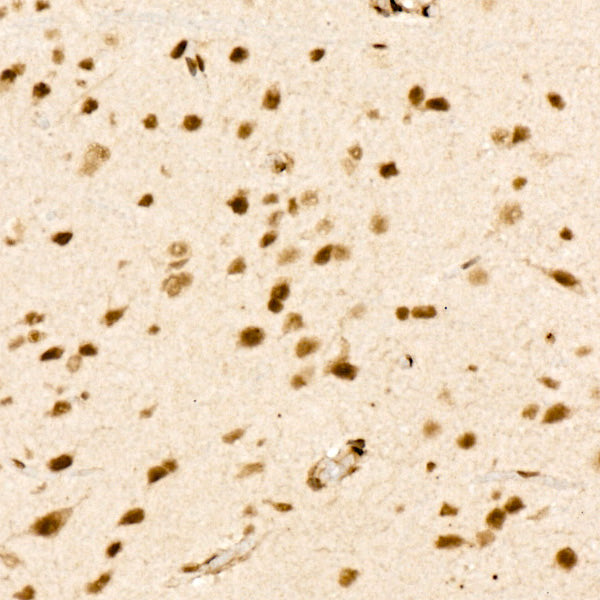 VDR Rabbit mAb