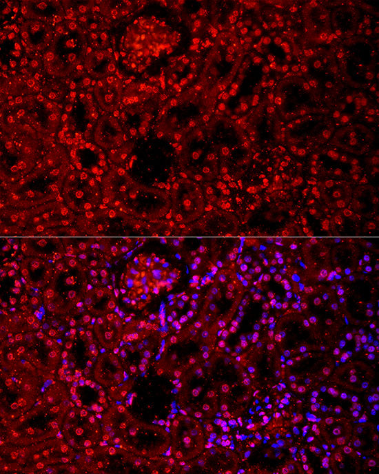 VDR Rabbit mAb