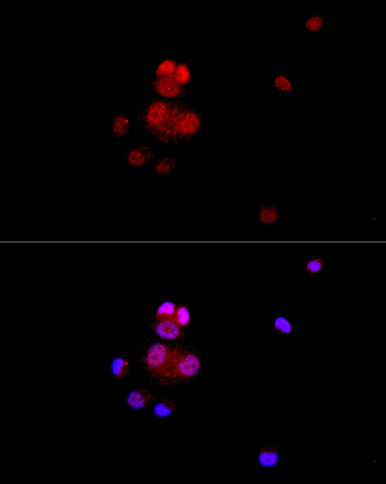 VDR Rabbit mAb