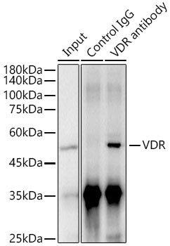 VDR Rabbit mAb