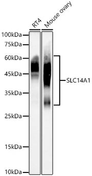 SLC14A1 Rabbit mAb