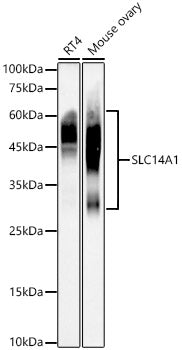 SLC14A1 Rabbit mAb