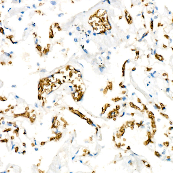 SLC14A1 Rabbit mAb