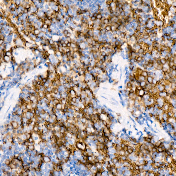 SLC14A1 Rabbit mAb