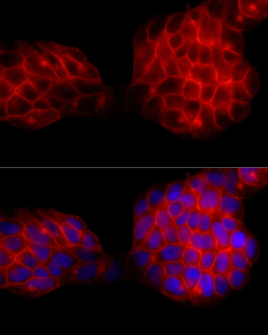 SLC14A1 Rabbit mAb