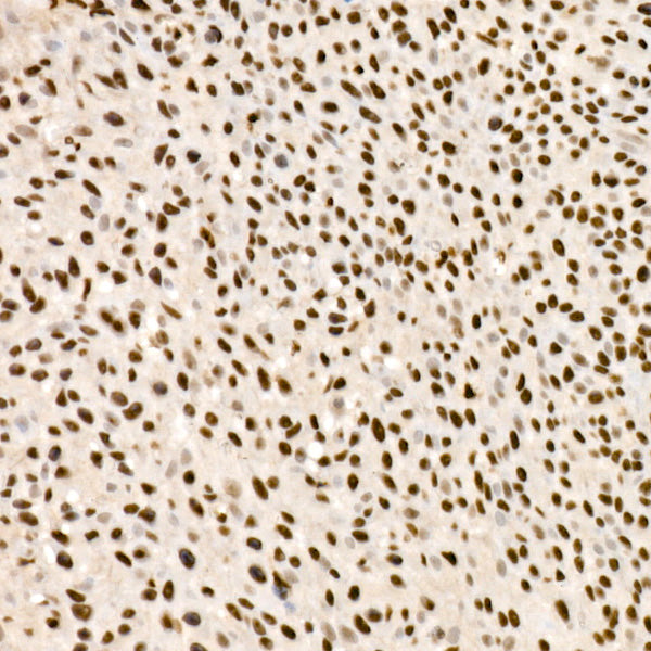 SMARCA2 / BRM Rabbit mAb