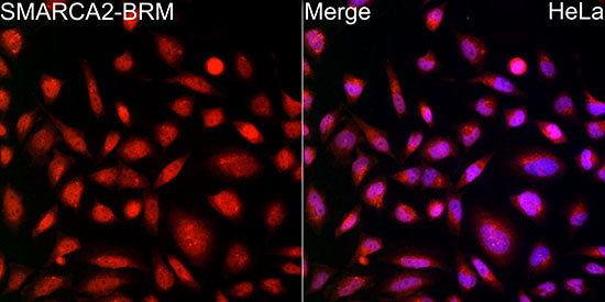 SMARCA2 / BRM Rabbit mAb