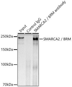 SMARCA2 / BRM Rabbit mAb