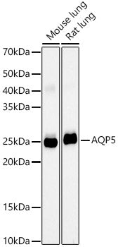 AQP5 Rabbit mAb