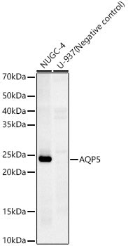 AQP5 Rabbit mAb