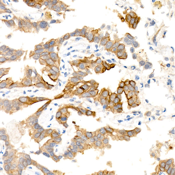 AQP5 Rabbit mAb