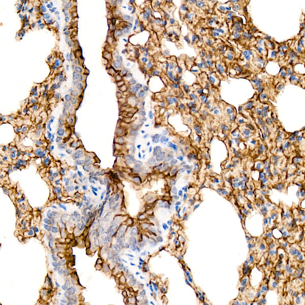 AQP5 Rabbit mAb