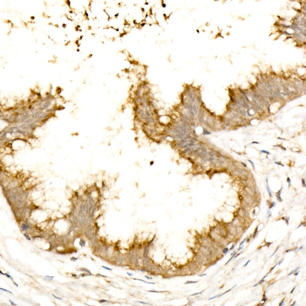 GOLGA4 Rabbit mAb