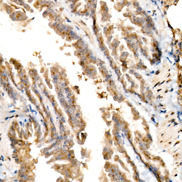 GOLGA4 Rabbit mAb