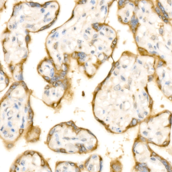 IGF2BP3/IMP3 Rabbit mAb