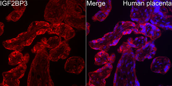 IGF2BP3/IMP3 Rabbit mAb