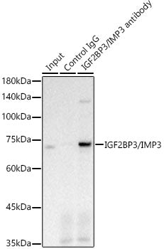 IGF2BP3/IMP3 Rabbit mAb