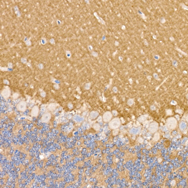 NCAM /CD56 Rabbit mAb