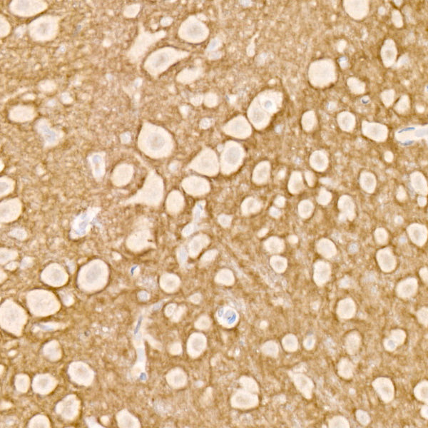 NCAM /CD56 Rabbit mAb