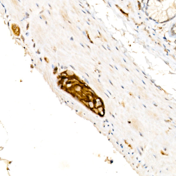 NCAM /CD56 Rabbit mAb
