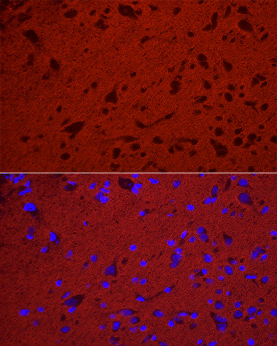 NCAM /CD56 Rabbit mAb