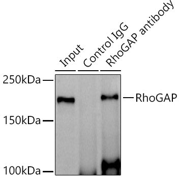 RhoGAP Rabbit mAb
