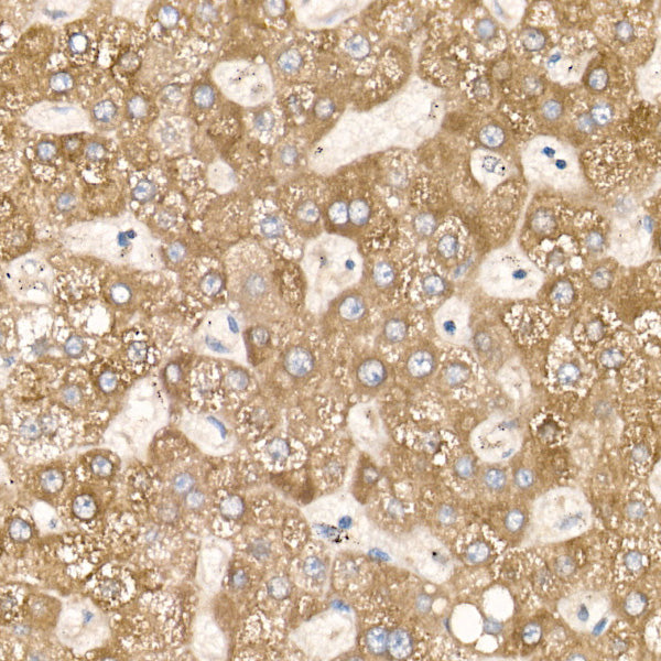 CYP51A1 Rabbit mAb