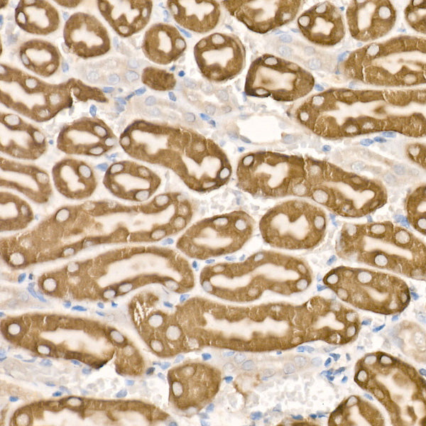CYP51A1 Rabbit mAb