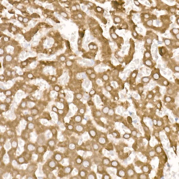 CYP51A1 Rabbit mAb