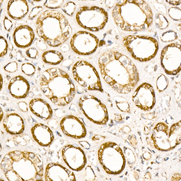 Citrate synthetase Rabbit mAb