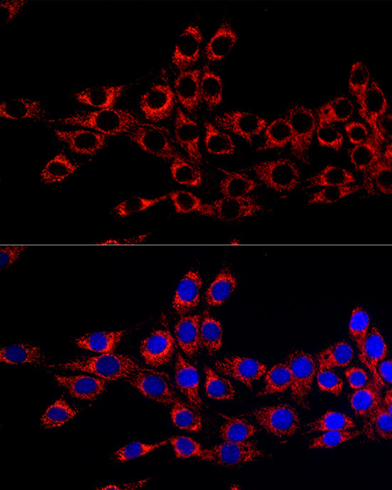 Citrate synthetase Rabbit mAb