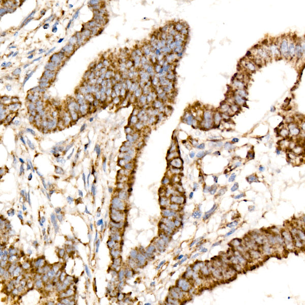 Citrate synthetase Rabbit mAb