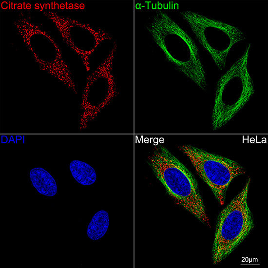Citrate synthetase Rabbit mAb