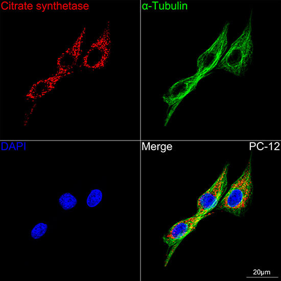 Citrate synthetase Rabbit mAb