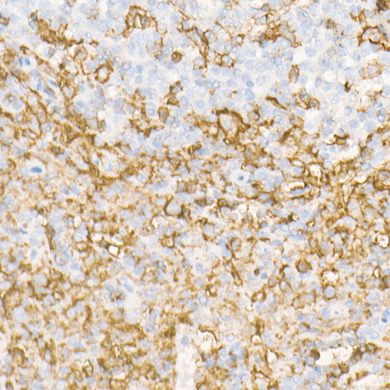CD162/PSGL-1 Rabbit mAb