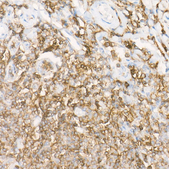 CD162/PSGL-1 Rabbit mAb