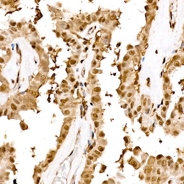 Proteasome 20S LMP7/PSMB8 Rabbit mAb