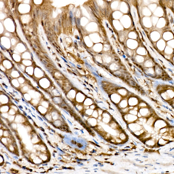 Proteasome 20S LMP7/PSMB8 Rabbit mAb
