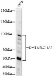 DMT1/SLC11A2 Rabbit mAb