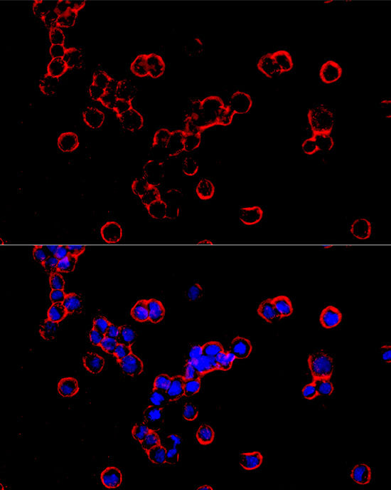 DMT1/SLC11A2 Rabbit mAb