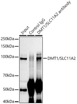 DMT1/SLC11A2 Rabbit mAb