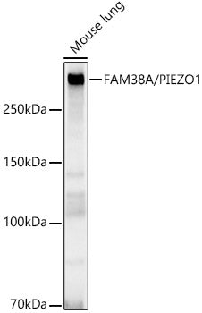 [KO Validated] FAM38A/PIEZO1 Rabbit mAb