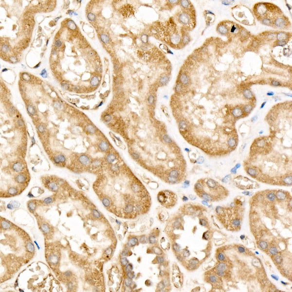 [KO Validated] FAM38A/PIEZO1 Rabbit mAb