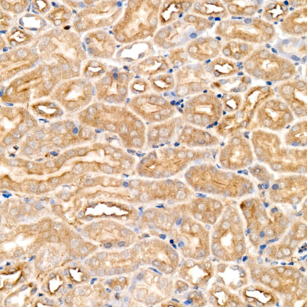 [KO Validated] FAM38A/PIEZO1 Rabbit mAb