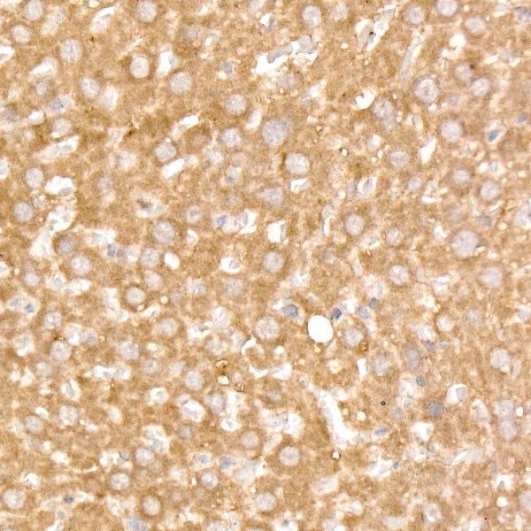 [KO Validated] FAM38A/PIEZO1 Rabbit mAb
