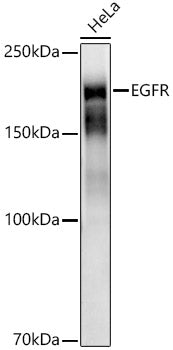 [KD Validated] EGFR Rabbit mAb