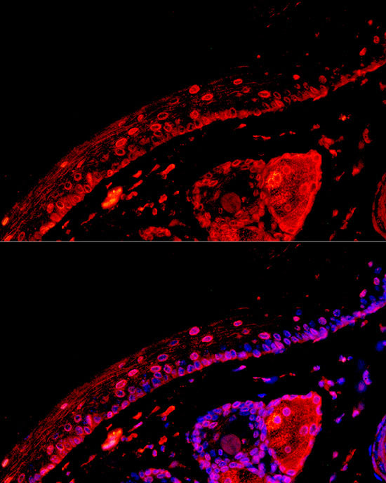 [KD Validated] EGFR Rabbit mAb