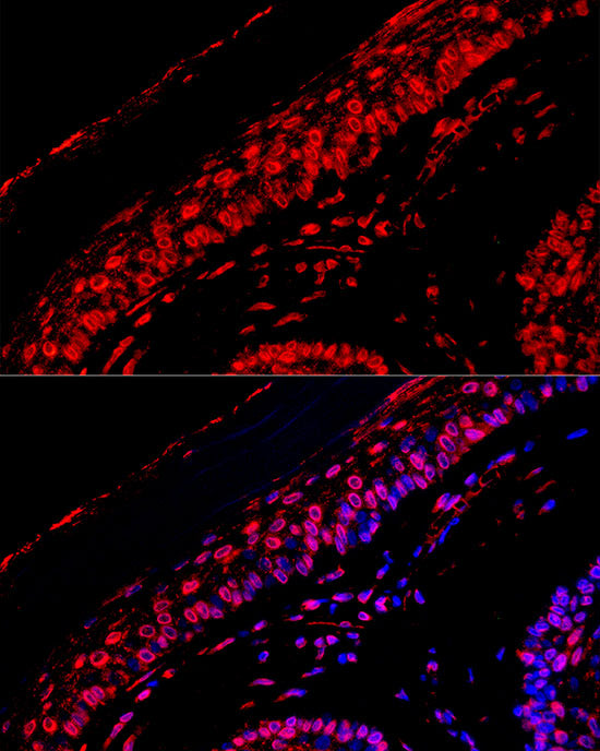 [KD Validated] EGFR Rabbit mAb